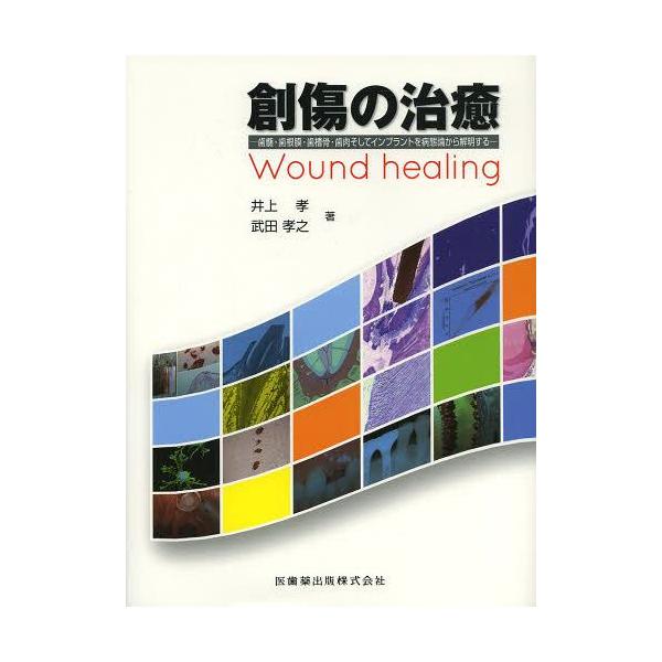 【送料無料】[本/雑誌]/創傷の治癒 歯髄・歯根膜・歯槽骨・歯肉そしてインプラントを病態論から解明する/井上孝/著 武田孝之/著(単行本・ムック)