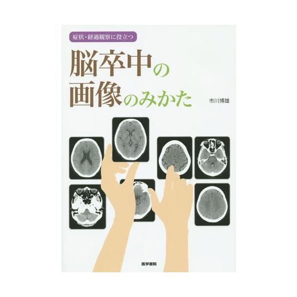 [Release date: July 29, 2014]市川博雄/著/脳卒中の画像のみかた 症状・経過観察に役立つ、メディア：BOOK、発売日：2014/07、重量：340g、商品コード：NEOBK-1694540、JANコード/ISBN...