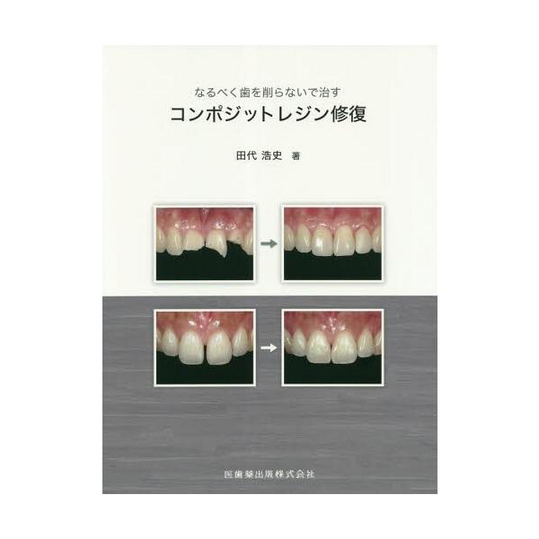 [Release date: April 28, 2018]田代浩史/著/コンポジットレジン修復 (なるべく歯を削らないで治す)、メディア：BOOK、発売日：2018/04、重量：271g、商品コード：NEOBK-2223063、JANコー...