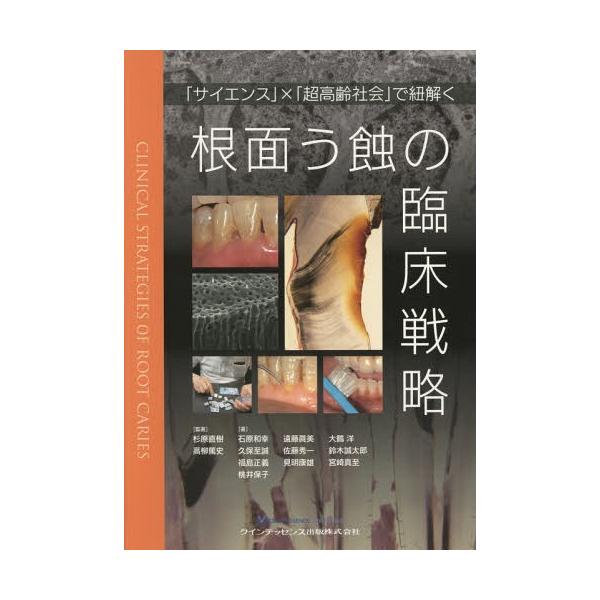 【送料無料】[本/雑誌]/根面う蝕の臨床戦略 「サイエンス」×「超高齢社会」で紐解く/杉原直樹/監著 高柳篤史/監著
