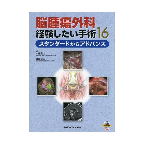 【送料無料】[本/雑誌]/脳腫瘍外科経験したい手術16 スタンダードからアドバンス/中尾直之/編集 井川房夫/編集