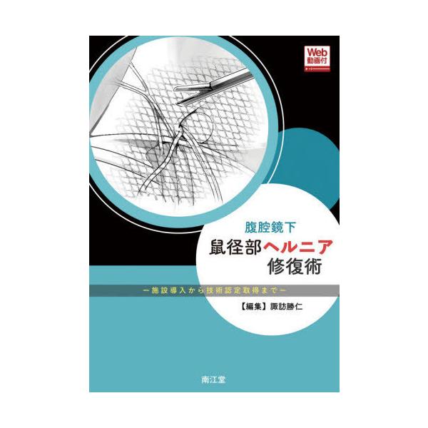 翌日発送・腹腔鏡下鼠径部ヘルニア修復術/諏訪勝仁