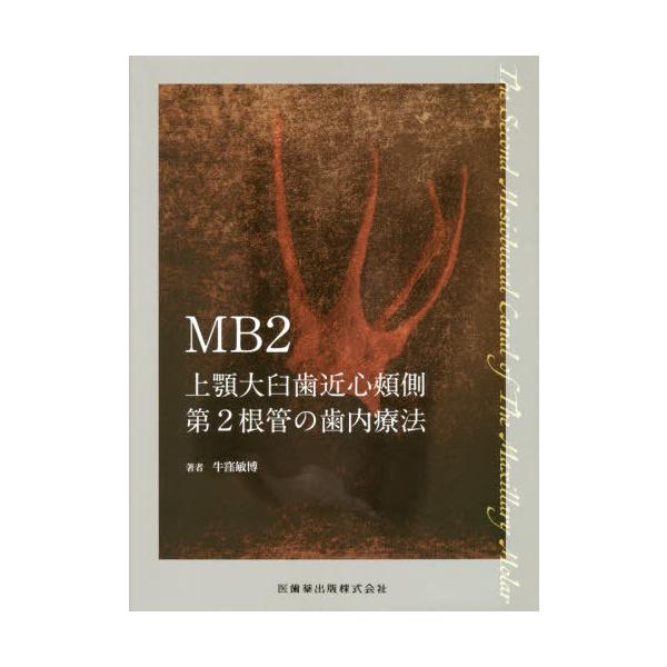 [Release date: June 28, 2020]牛窪敏博/著/MB2 上顎大臼歯近心頬側第2根管の歯内療法、メディア：BOOK、発売日：2020/06、重量：340g、商品コード：NEOBK-2509355、JANコード/ISBN...