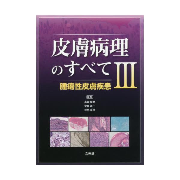 送料無料】[本/雑誌]/皮膚病理のすべて 3 腫瘍性皮膚疾患/真鍋俊明