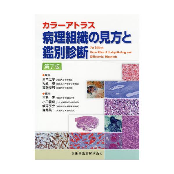 カラーアトラス 病理組織の見方と鑑別診断 第7版 送料無料】[本/雑誌]/病理組織の見方と鑑別診断 第7版 (カラー