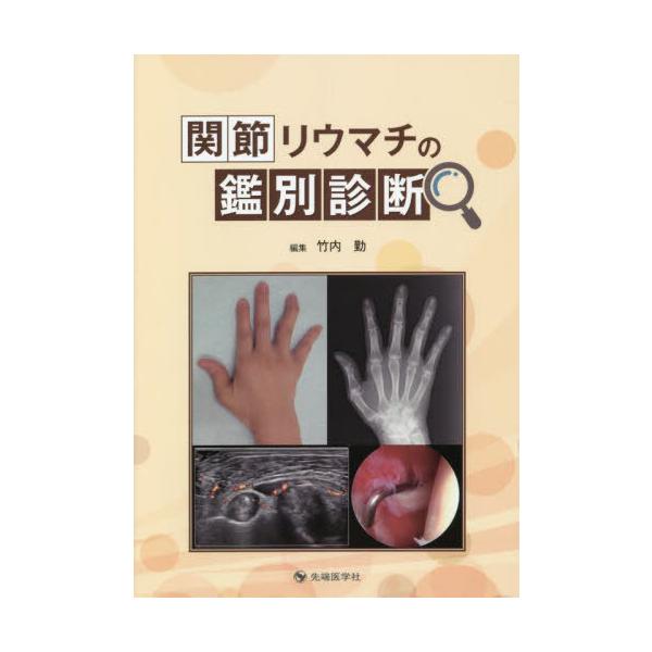 [本/雑誌]/関節リウマチの鑑別診断/竹内勤/編集