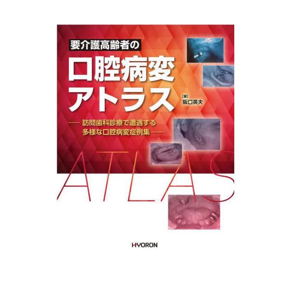 【送料無料】[本/雑誌]/要介護高齢者の口腔病変アトラス/阪口英夫/著