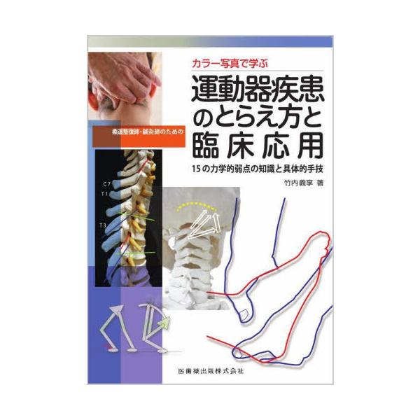 [本/雑誌]/柔道整復師・鍼灸師のための運動器疾患のと/竹内義享/著