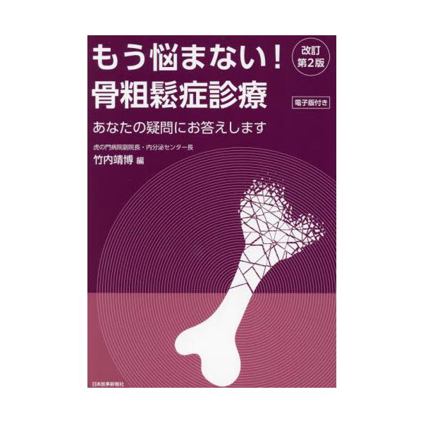 【中古】もう悩まない骨粗鬆症診療　改訂第2版