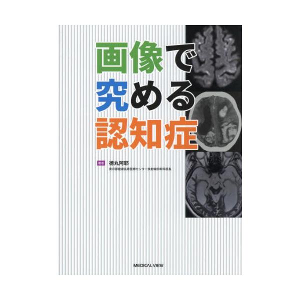 [Release date: March 16, 2025]徳丸阿耶/著/画像で究める認知症、メディア：BOOK、発売日：2025/03、重量：909g、商品コード：NEOBK-3077544、JANコード/ISBNコード：97847583...