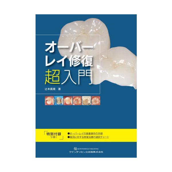 [Release date: May 11, 2025]辻本真規/著/オーバーレイ修復超入門、メディア：BOOK、発売日：2025/05、重量：710g、商品コード：NEOBK-3094268、JANコード/ISBNコード：97847812...
