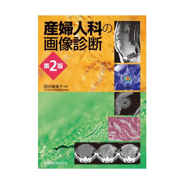 送料無料】[本/雑誌]/産婦人科の画像診断/田中優美子/著 : ネオ