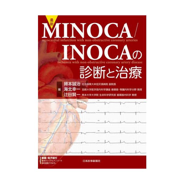 [Release date: November 15, 2025]掃本誠治/編 海北幸一/編 辻田賢一/編/最新MINOCA/INOCAの診断と治療、メディア：BOOK、発売日：2025/11、重量：500g、商品コード：NEOBK-315...