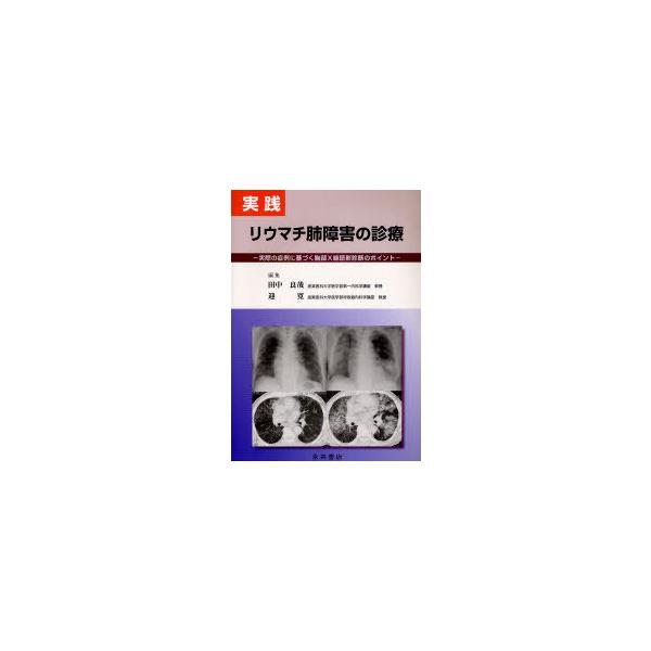 【送料無料】[本/雑誌]/実践リウマチ肺障害の診療 実際の症例に基づく胸部X線読影診断のポイント/田中良哉/編集 迎寛/編集 田中良哉/著 迎寛/著 齋藤和