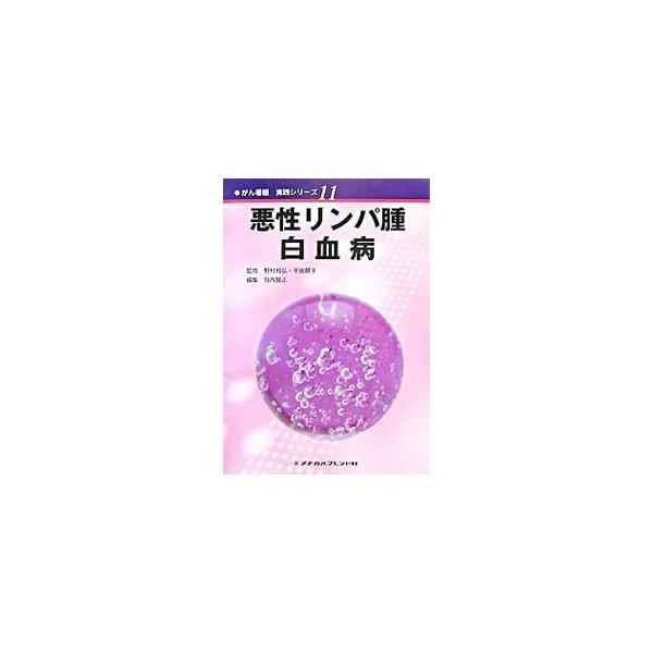 悪性リンパ腫・白血病／野村和弘