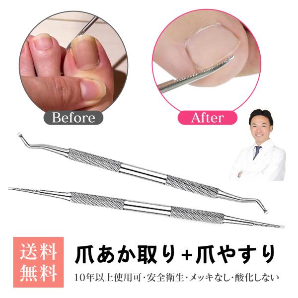 商品仕様■素材：ステンレススチール■サイズ：14x0.5cm■ パッケージ：爪やすり、爪垢取り2点セット専用収納ケース付きで持ち運びに便利！■重量：約10g/2点セット■生産地：China使用用途※ステンレス製で清潔感があります。爪やすりの...