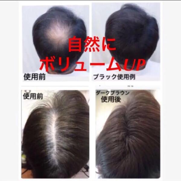 ボリュームアップヘアーファンデーション薄毛増毛ふりかけパウダー分け目つむじ生え際白髪隠し薄毛対策瞬間３d増毛マイクロヘアーパウダーボトル Buyee Buyee 日本の通販商品 オークションの代理入札 代理購入