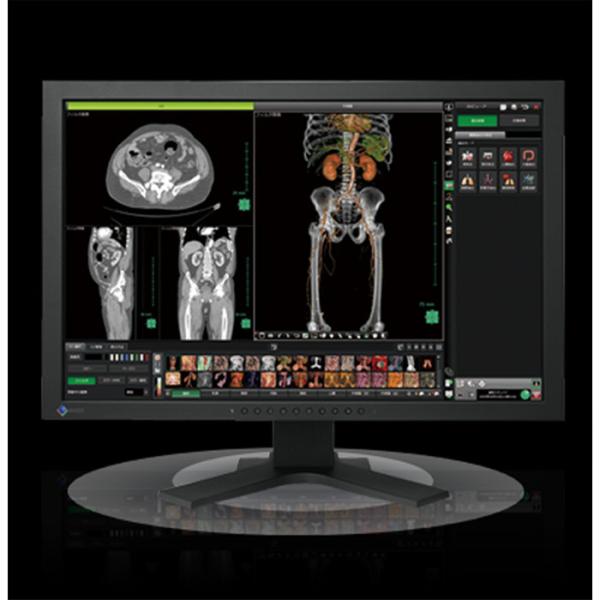 EIZO RadiForce MX215 21.3インチ医療用 モニター 楽天市場】EIZO RadiForce MX215 縦型 21.3インチ 1600 x 1200