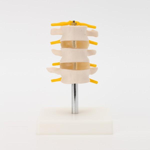 【特徴】【業界最安値に挑戦！】腰椎の構造をリアルに再現した3交連モデル【商品説明】腰椎（L3〜L5）と椎間板、脊髄神経を再現した人体模型です。実際の骨格から型取りしているので構造をリアルに再現しています。ネジ留め式で腰椎、椎間板、脊髄神経を...