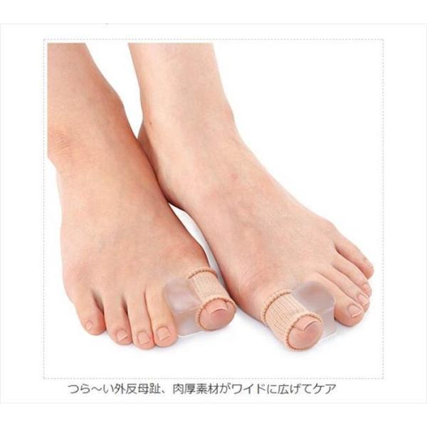 外反母趾 サポーター 矯正 ソルボ 足 シリコン パッド セール H01