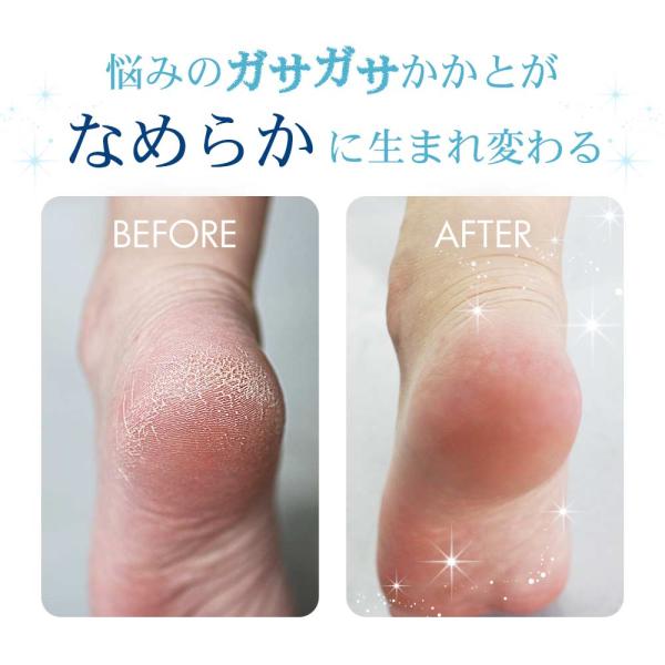 アシピカ かかと ひび割れ 角質ケア ガラス 足裏 角質除去 かかとケア 足の角質取り ガサガサ 角質削り フットケア お風呂 かかとヤスリ メール便a Ashi Pika おうちでらくらく お手軽美人 通販 Yahoo ショッピング