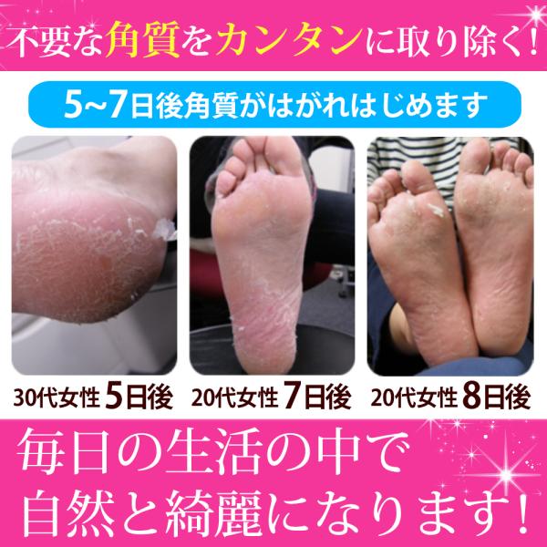 かかと 角質ケア パック ペロリン 6回分 足裏 角質除去 ひび割れ 乾燥 足の角質取り フットケア 履くだけ かかとケア フットピーリングパック メール便a Buyee Buyee Japanese Proxy Service Buy From Japan Bot Online