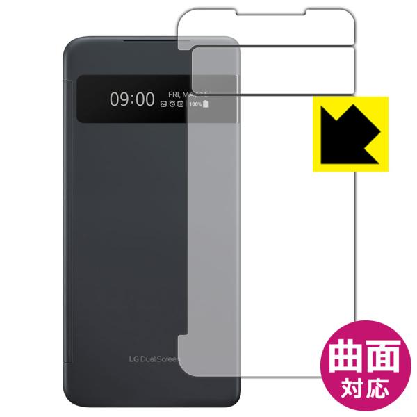 LG VELVET ȖʑΉŒ[܂łی یtB Flexible Shieldyz (LGfAXN[v\ʗp)