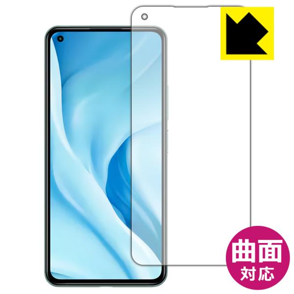 Xiaomi Mi 11 Lite 5G ȖʑΉŒ[܂łی یtB Flexible Shieldyz (Oʂ̂)