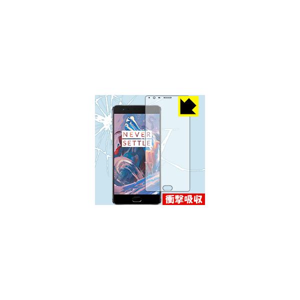 OnePlus 3 / 3T fނŏՌzIیtB Ռzyz