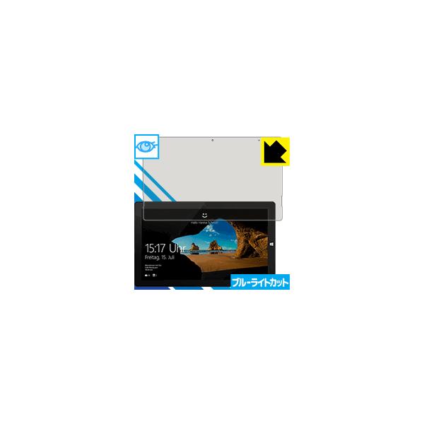 TREKSTOR Primetab T13B LEDtʂ̃u[Cg35%JbgIیtB u[CgJbgyz