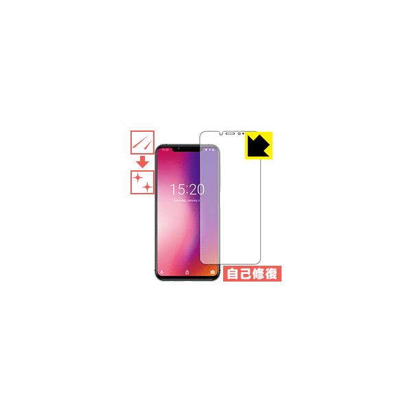UMIDIGI One Pro / UMIDIGI One RɕtĂ܂XCIیtB LYȏC (Oʂ̂)