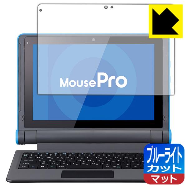 MousePro P101V[Y (MousePro-P101A) LEDtʂ̃u[Cg34%JbgIیtB u[CgJbgy˒ጸz