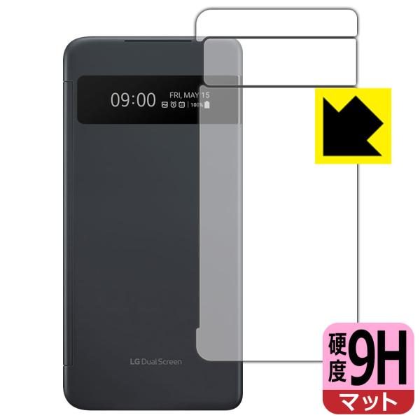 LG VELVET PETtBȂ̂ɋKX̍dxIیtB 9Hdxy˒ጸz (LGfAXN[v\ʗp)