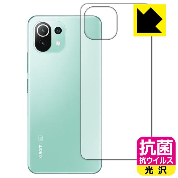 Xiaomi Mi 11 Lite 5G ې\ԎI R RECXyzیtB (wʂ̂)