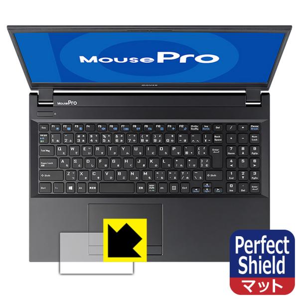 MousePro NB530 / NB520 / NB510V[Y hCAEhw!˒ጸیtB Perfect Shield (^b`pbhp)