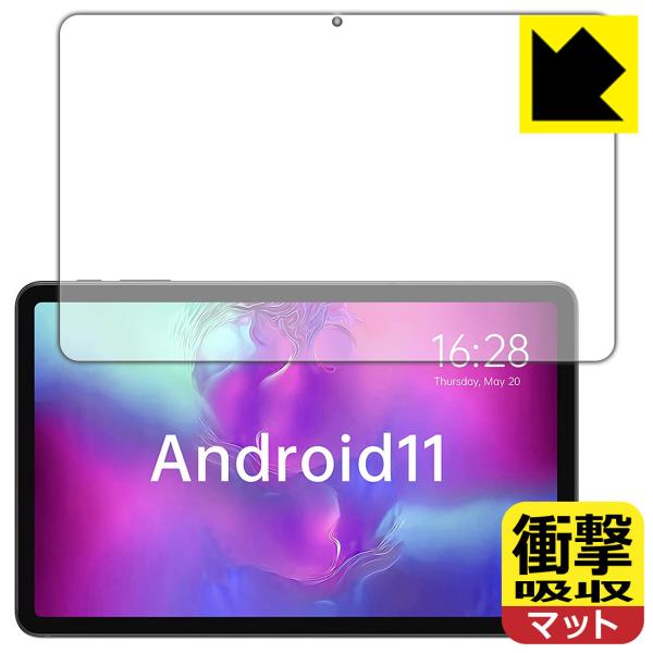 ALLDOCUBE iPlay 40 Pro fނŏՌzIیtB Ռzy˒ጸz