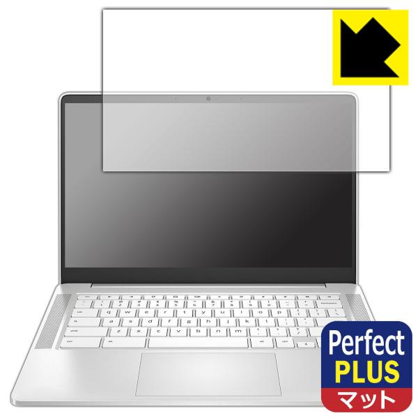 HP Chromebook 14a-nd0000V[YΉ Perfect Shield Plus ی tB ˒ጸ hw {