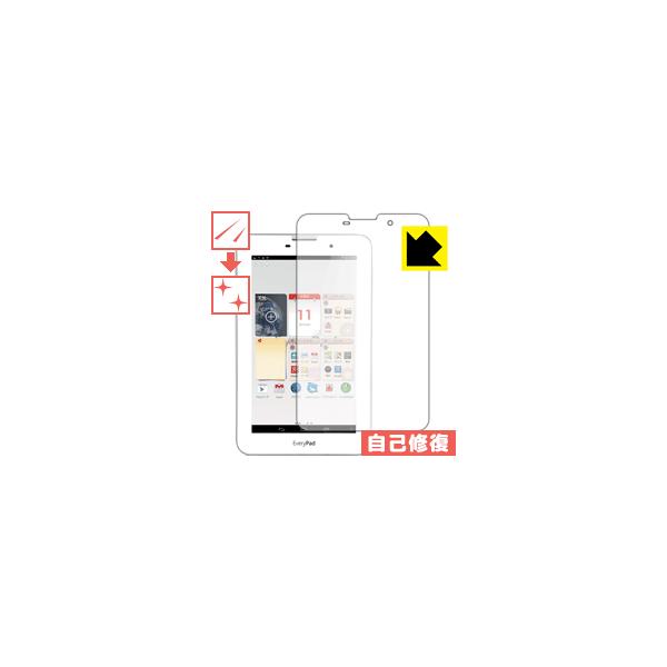 everypad」の人気商品一覧 | 安い商品を通販サイトから探す - 価格.com