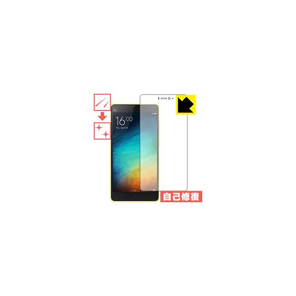 Xiaomi Mi 4c �ی�t�B���� �L�Y���ȏC��