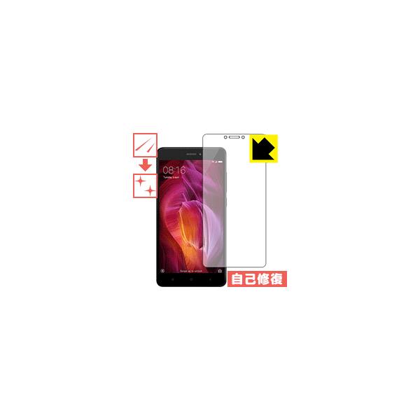 Xiaomi Redmi Note 4 (Snapdragon��) ���R�ɕt���Ă��܂��X�������C���I�ی�t�B���� �L�Y���ȏC��