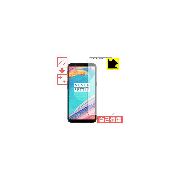 OnePlus 5T ���R�ɕt���Ă��܂��X�������C���I�ی�t�B���� �L�Y���ȏC��