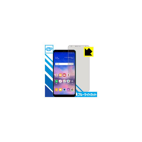 LG Q Stylus (LM-Q710XM) LEDtʂ̃u[Cg35%JbgIیtB u[CgJbgyz