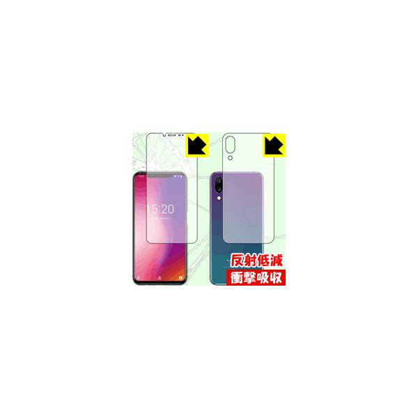 UMIDIGI One Pro / UMIDIGI One fނŏՌzIیtB Ռzy˒ጸz (ʃZbg)