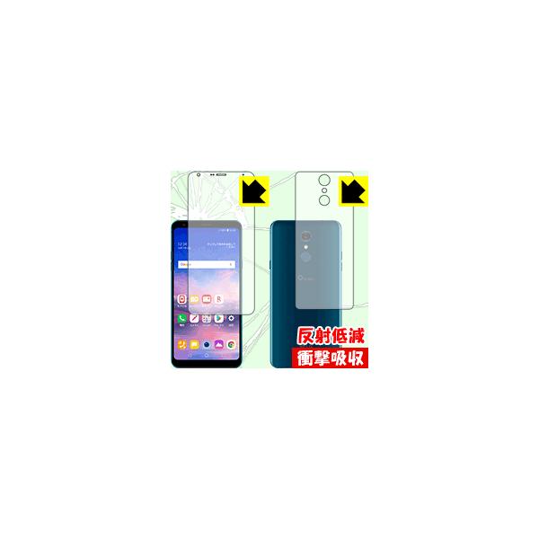 LG Q Stylus (LM-Q710XM) fނŏՌzIیtB Ռzy˒ጸz (ʃZbg)