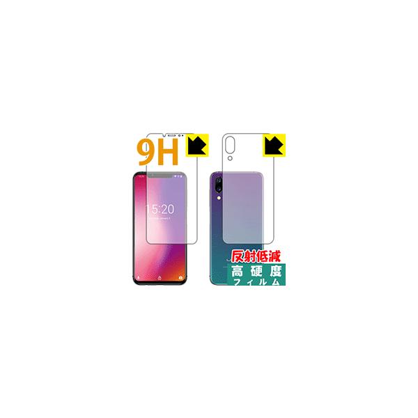 UMIDIGI One Pro / UMIDIGI One PETtBȂ̂ɋKX̍dxIیtB 9Hdxy˒ጸz (ʃZbg)