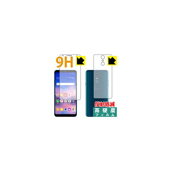 LG Q Stylus (LM-Q710XM) PETtBȂ̂ɋKX̍dxIیtB 9Hdxy˒ጸz (ʃZbg)