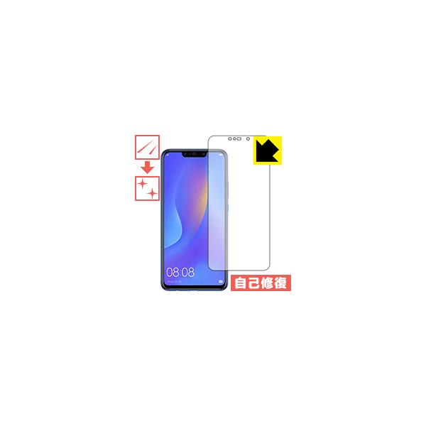 HUAWEI nova 3i ���R�ɕt���Ă��܂��X�������C���I�ی�t�B���� �L�Y���ȏC�� (�O�ʂ̂�)