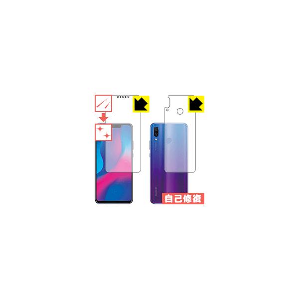 HUAWEI nova 3 ���R�ɕt���Ă��܂��X�������C���I�ی�t�B���� �L�Y���ȏC�� (���ʃZ�b�g)