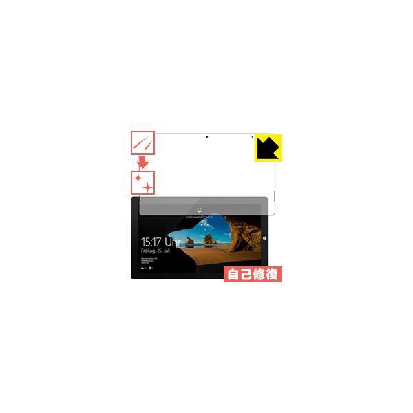 TREKSTOR Primetab T13B ���R�ɕt���Ă��܂��X�������C���I�ی�t�B���� �L�Y���ȏC��