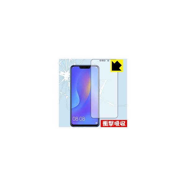 HUAWEI nova 3i fނŏՌzIیtB Ռzyz (Oʂ̂)